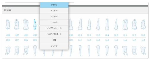 Fixed Restorative Rx 入力必須項目(シングルクラウン インレー編)4