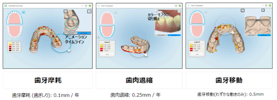 タイムラプス使用方法4