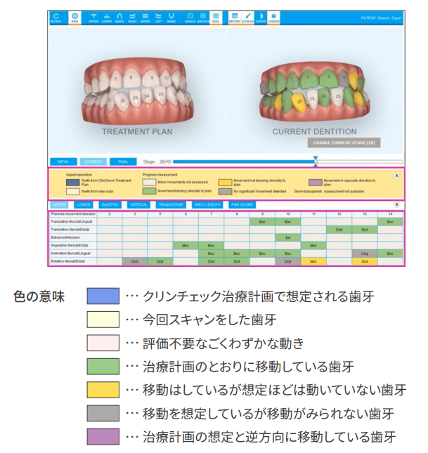 プログレスアセスメント早見表