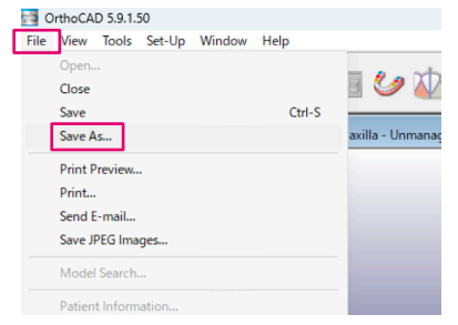 OrthoCAD 歯の計測17