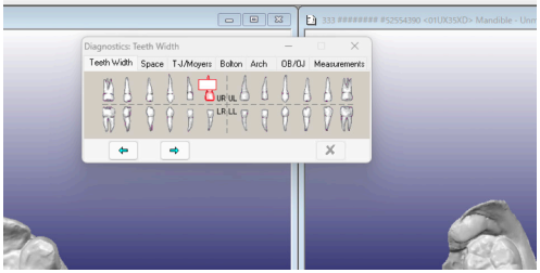 OrthoCAD 歯の計測5